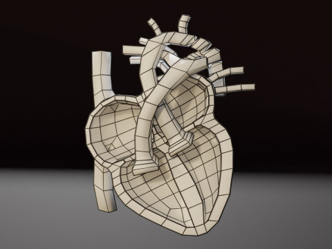 COA Coarctation of Aorta 3D Model