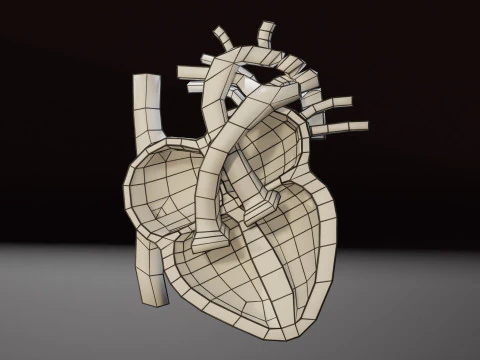 COA Coartaci&oacute;n de Aorta Modelo 3D