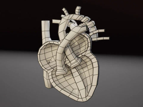 COA Coartaci&oacute;n de Aorta Modelo 3D