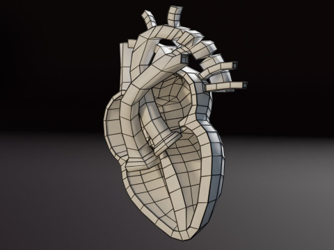 COA Coarctation of Aorta 3D Model