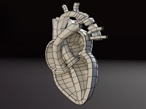 COA Coartaci&oacute;n de Aorta Modelo 3D