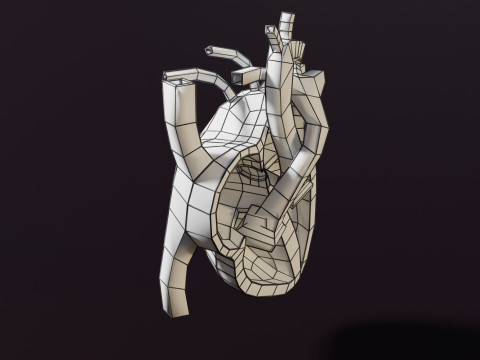COA Coarctation of Aorta 3D Model