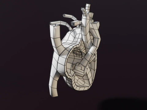 COA Coartaci&oacute;n de Aorta Modelo 3D