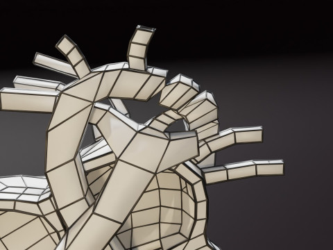 COA Coarctation of Aorta 3D Model