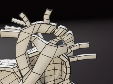 COA Coartaci&oacute;n de Aorta Modelo 3D