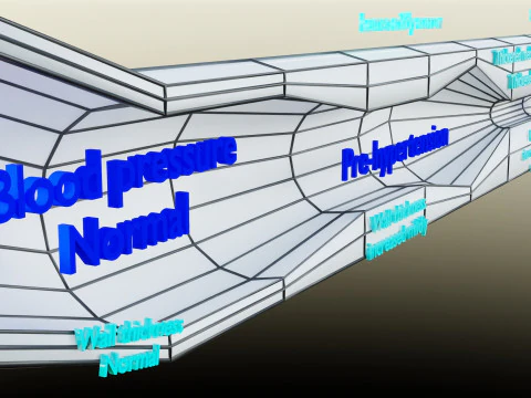 Hypertension blood vessel artery structural change 3D Model