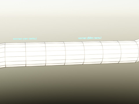 Hypertension blood vessel artery structural change 3D-Modell