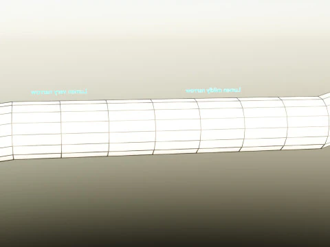 Hypertension blood vessel artery structural change 3D Model