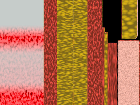 Hypertension blood vessel artery structural change 3D-Modell