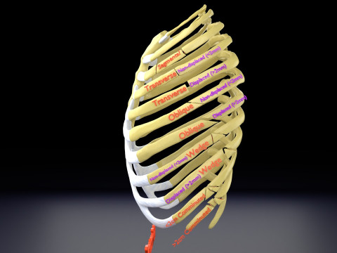Rib fracture and its types Model 3D