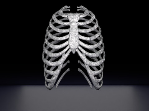 Rib fracture and its types Model 3D