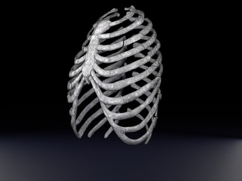 Rib fracture and its types Model 3D