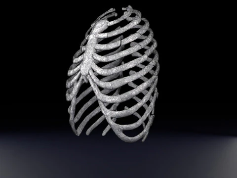 Rib fracture and its types 3D Model