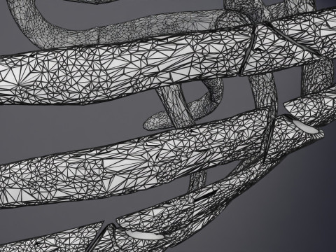 Rib fracture and its types Model 3D