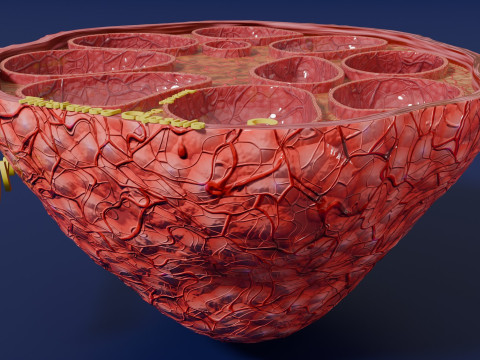 Polycystic Ovary Disease PCOD 3D 모델