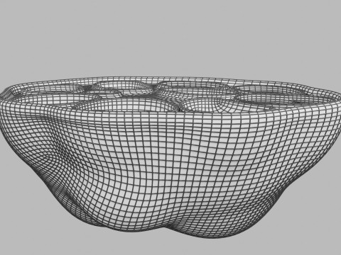 Polycystic Ovary Disease PCOD 3D 모델