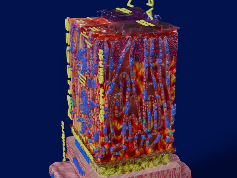 Stomach Gastric acid peptic disease ulcer Model 3D