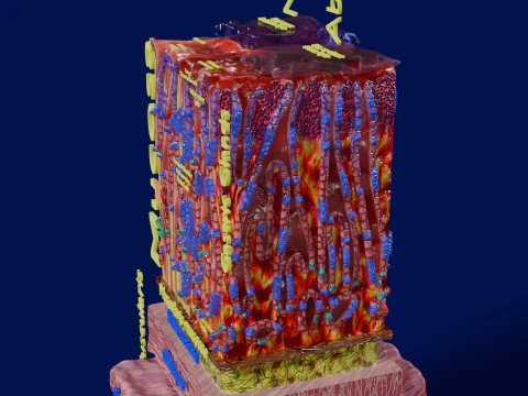 Stomach Gastric acid peptic disease ulcer 3D Model
