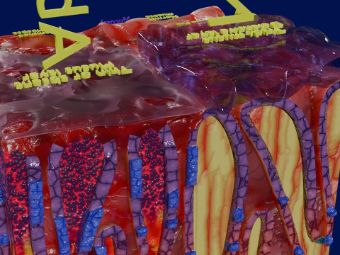 Stomach Gastric acid peptic disease ulcer Model 3D