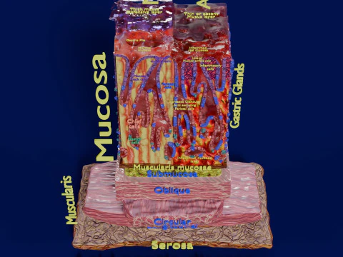 Stomach Gastric acid peptic disease ulcer 3D Model