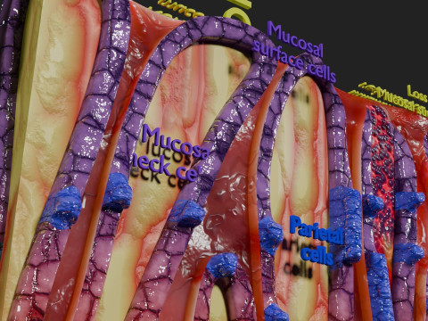 Stomach Gastric acid peptic disease ulcer Model 3D