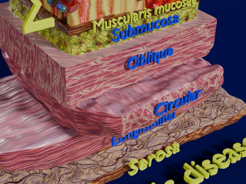 Stomach Gastric acid peptic disease ulcer Model 3D