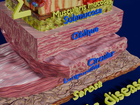 Stomach Gastric acid peptic disease ulcer 3D Model