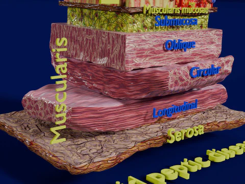 Stomach Gastric acid peptic disease ulcer 3D Model
