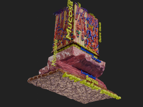 Stomach Gastric acid peptic disease ulcer Model 3D