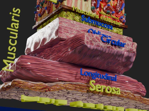 Stomach Gastric acid peptic disease ulcer 3D Model