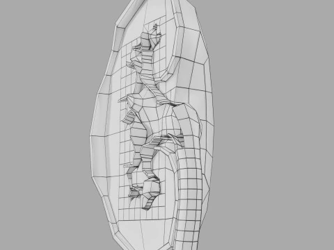 Kidney stone nephrolithiasis Staghorn calculus 3D Model