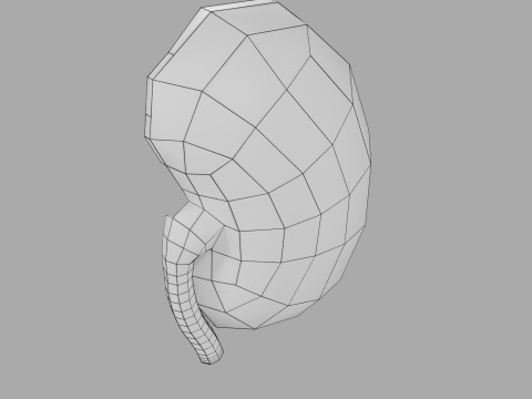 Kidney stone nephrolithiasis Staghorn calculus 3Dモデル