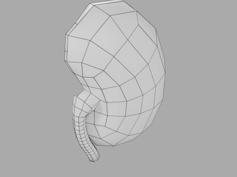 Kidney stone nephrolithiasis Staghorn calculus 3D Model