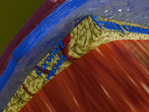 Heart Cardiac Wall Layers 3D Model