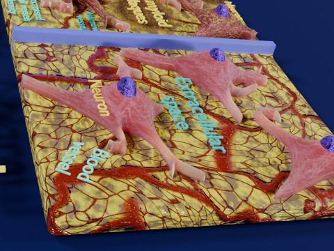 Alzheimer disease microscopy changes brain Modelo 3D