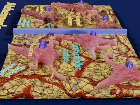 Alzheimer disease microscopy changes brain Modelo 3D