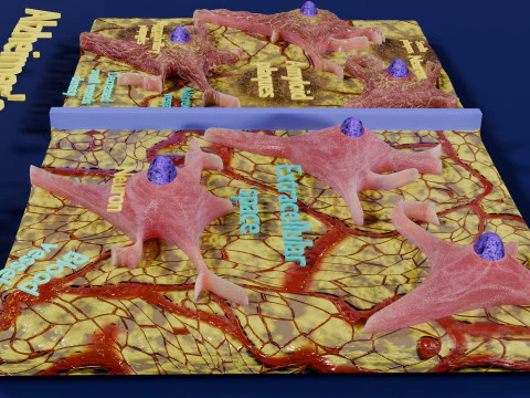 Alzheimer disease microscopy changes brain 3D Model