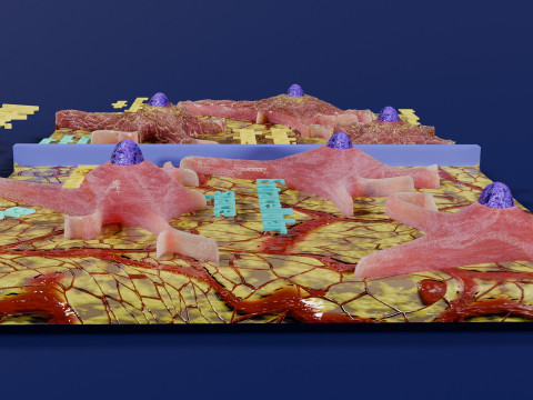 Alzheimer disease microscopy changes brain Modelo 3D