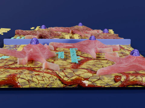Alzheimer disease microscopy changes brain 3D Model