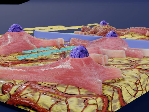 Alzheimer disease microscopy changes brain 3D Model