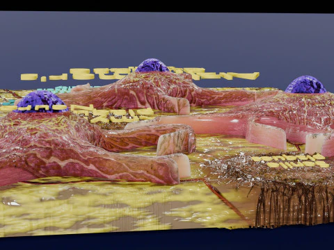 Alzheimer disease microscopy changes brain 3D Model