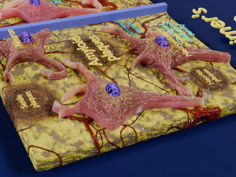 Alzheimer disease microscopy changes brain 3D Model