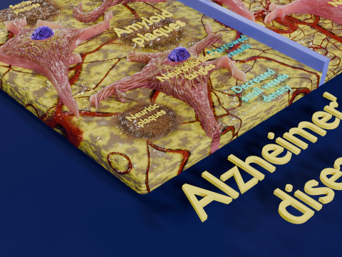 Alzheimer disease microscopy changes brain Modelo 3D