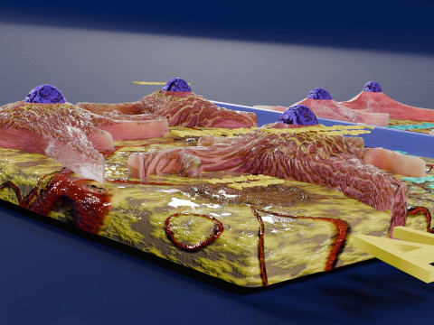 Alzheimer disease microscopy changes brain Modelo 3D
