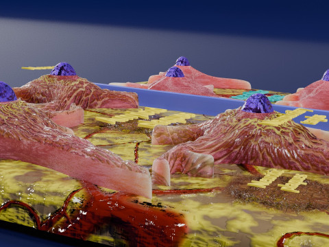 Alzheimer disease microscopy changes brain Modelo 3D