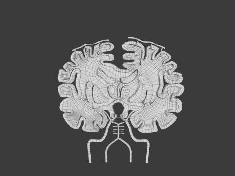 Stroke brain infarct hemorrhage types 3D 모델