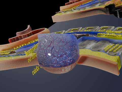 Spina bifida Neural Tube Defect 3D Model