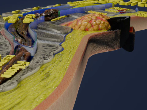 Spina bifida Neural Tube Defect 3D Model