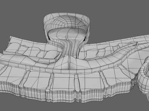 Spina bifida Neural Tube Defect 3D Model