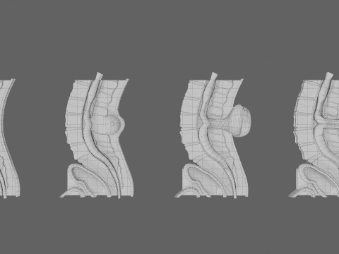 Spina bifida Neural Tube Defect 3D Model